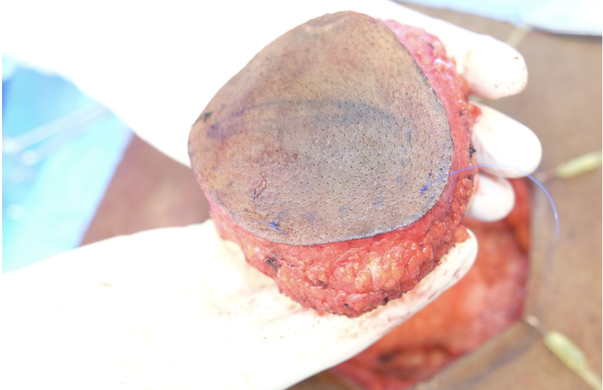 Figure 1: Primary Mass