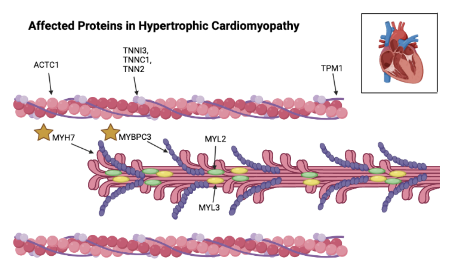Schematic of sarcomere structure showing proteins of thin and thick filament associated with familial hypertrophic cardiomyopathy